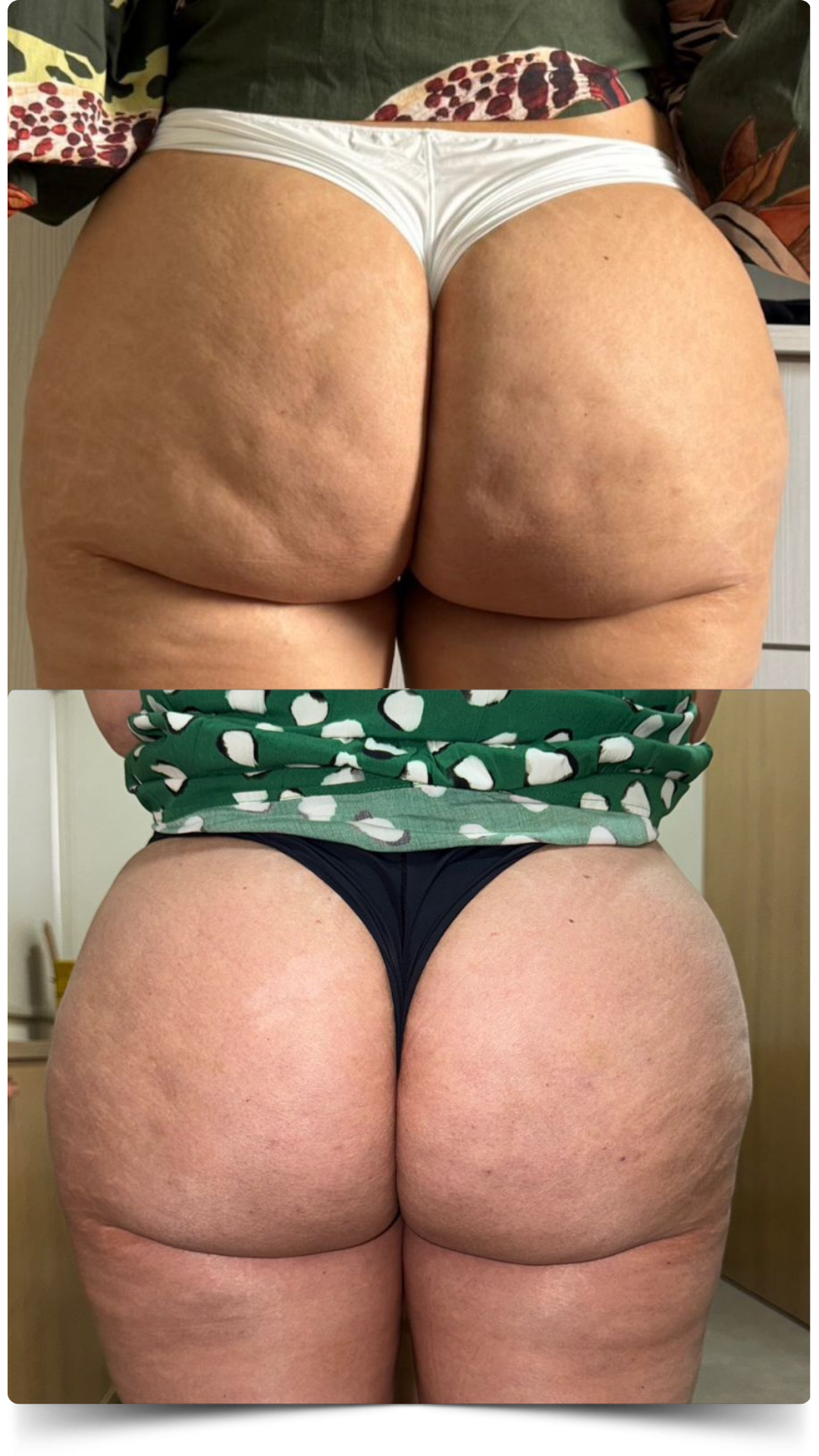 Antes e Depois