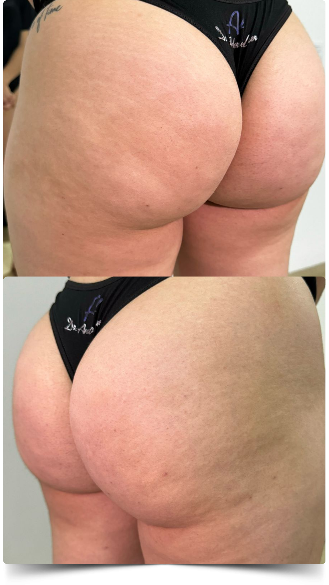 Antes e Depois (3)