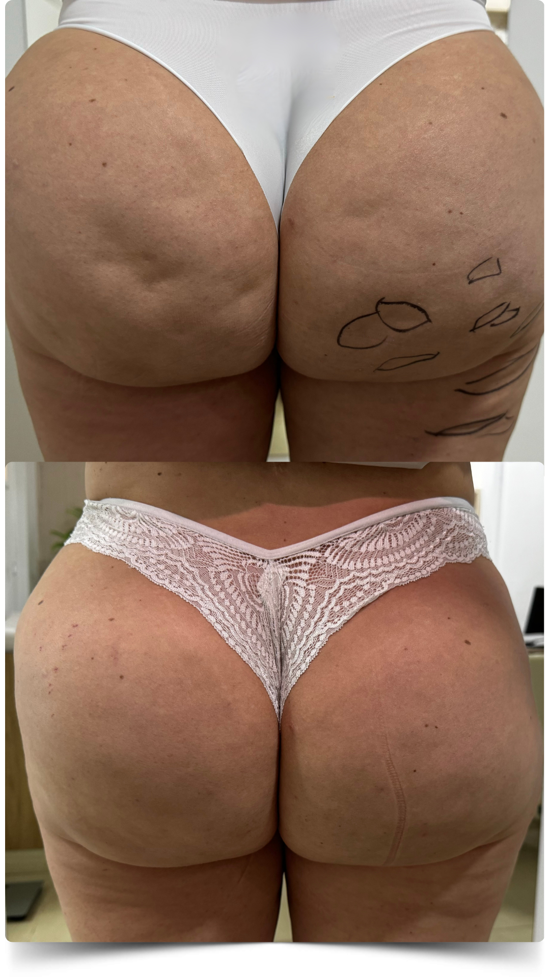 Antes e Depois - cópia